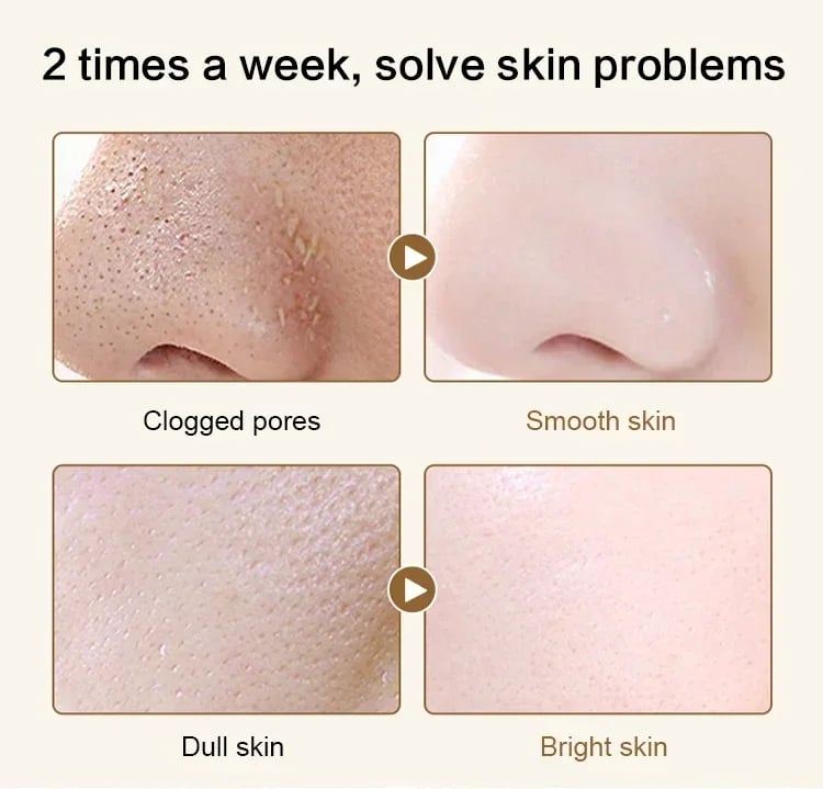 🔥Retinol Snake Venom Peptide Gold Mask