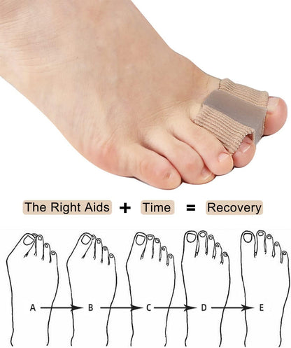 2PCS Gel Bunion Toe Separators – Pain Relief Toe Corrector & Hammer Toe Straightener for Women and Men