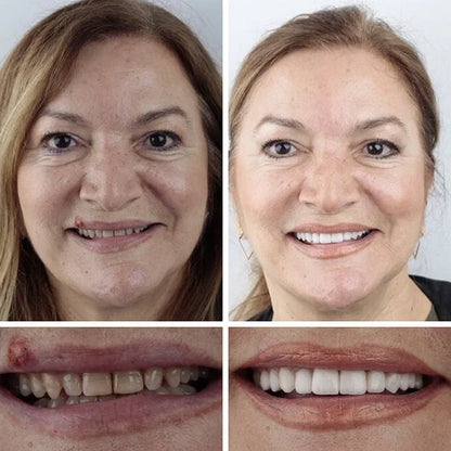 🎁Final 3 Hours! 🏆 2026 Best Seller
