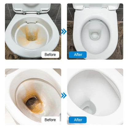 🌎Ends Today: 40% OFF!⏰KLENIMORE™ Custom-Fit Smile Support Kit — Strong Suction Feel & Natural-Looking Fit